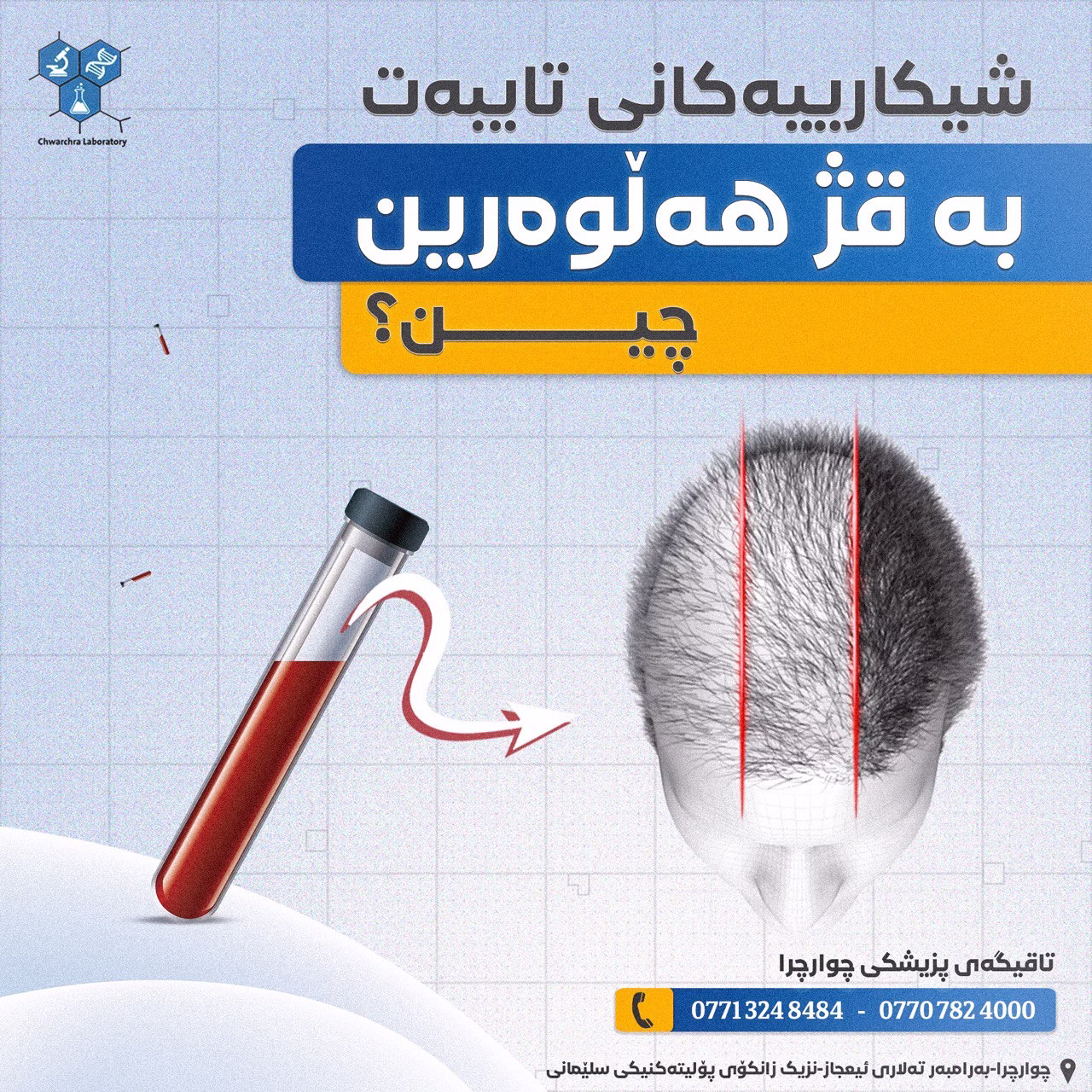 شیکارییەکانی تایبەت بە قژ هەڵوەرین چین؟